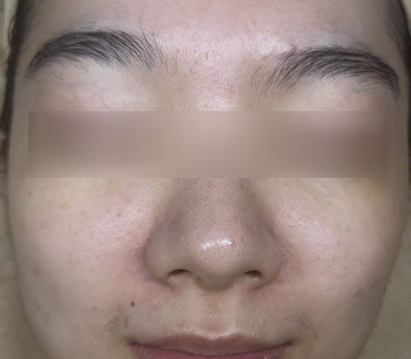 LINE_ALBUM_客照_250407_1 伊登蕾雅美學顧客案例