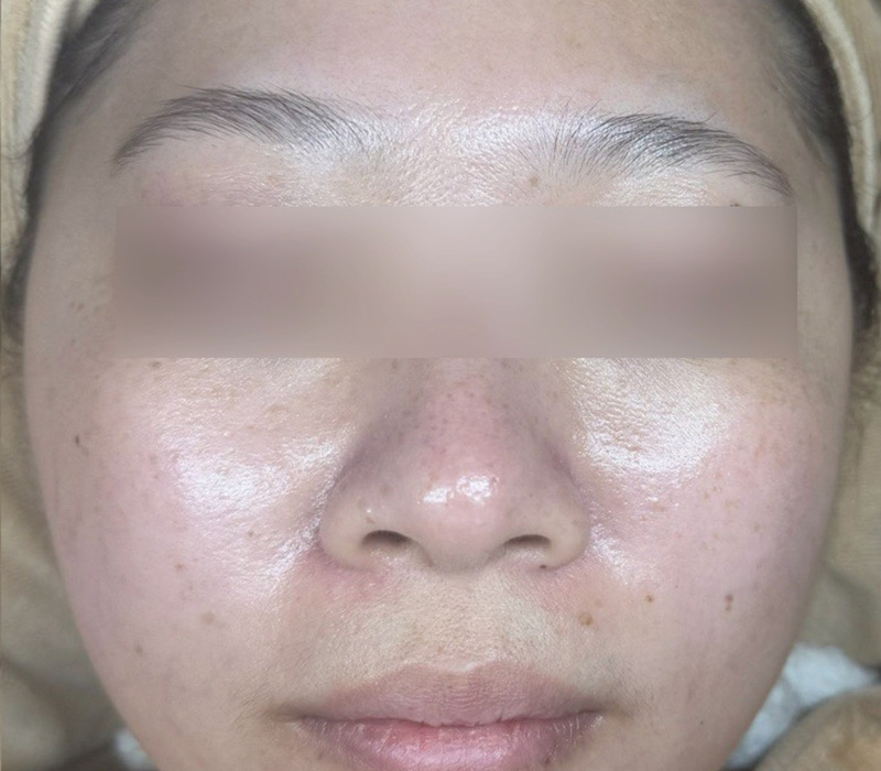 LINE_ALBUM_客照_250407_10 伊登蕾雅美學顧客案例