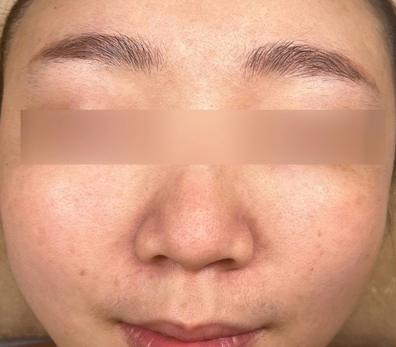 LINE_ALBUM_客照_250407_11 伊登蕾雅美學顧客案例