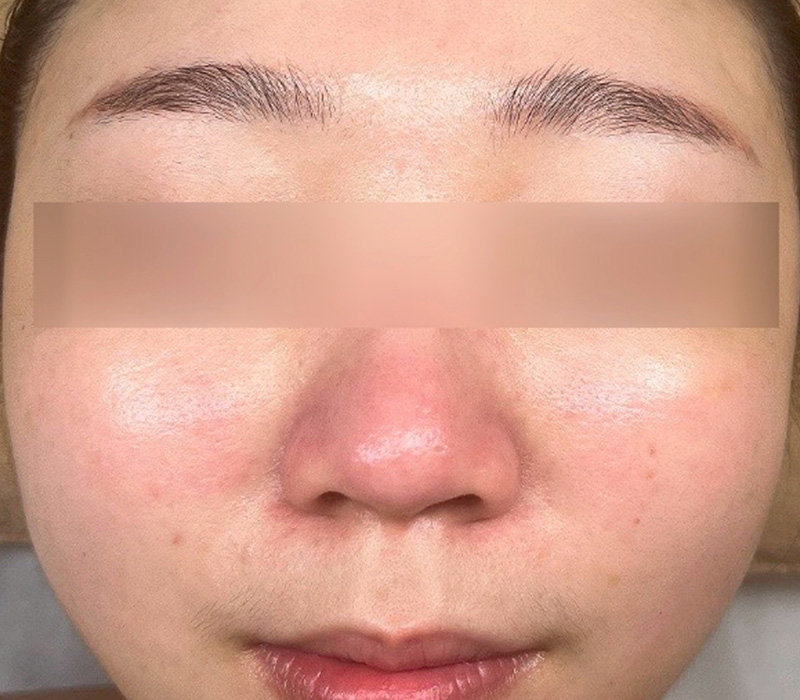 LINE_ALBUM_客照_250407_12 伊登蕾雅美學顧客案例