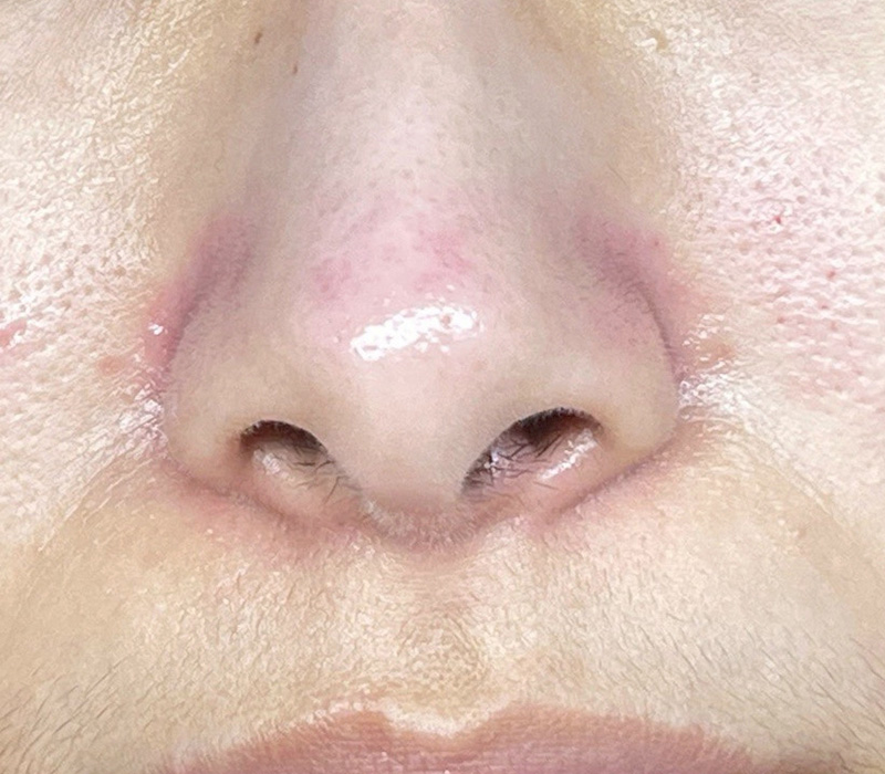 LINE_ALBUM_客照_250407_14 伊登蕾雅美學顧客案例