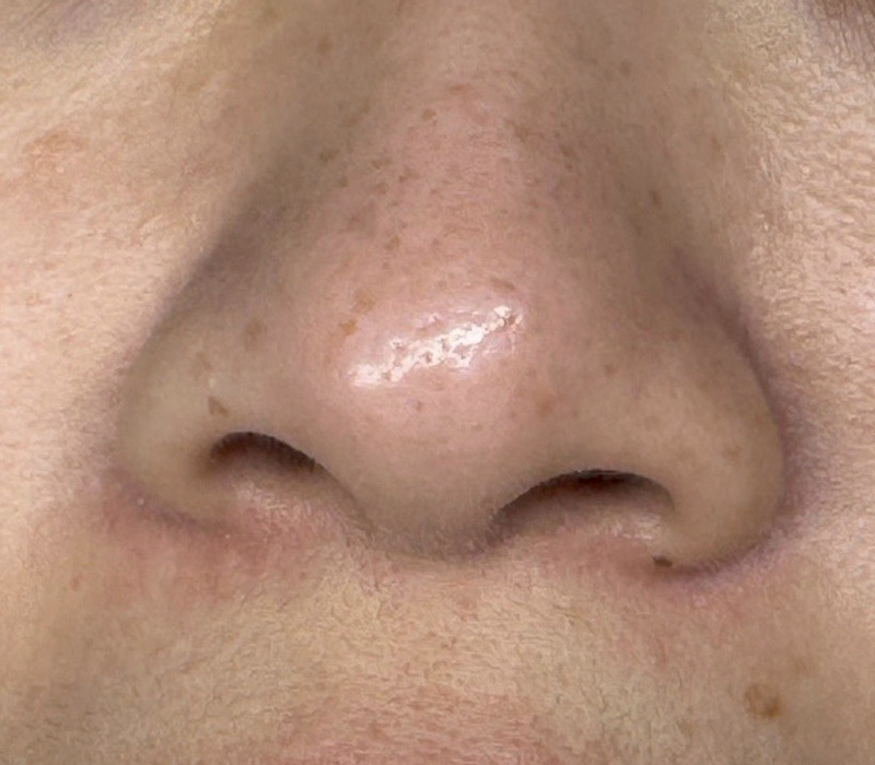 LINE_ALBUM_客照_250407_15 伊登蕾雅美學顧客案例