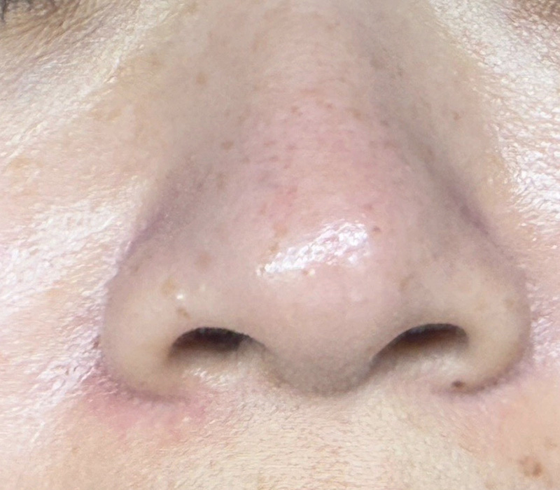 LINE_ALBUM_客照_250407_16 伊登蕾雅美學顧客案例