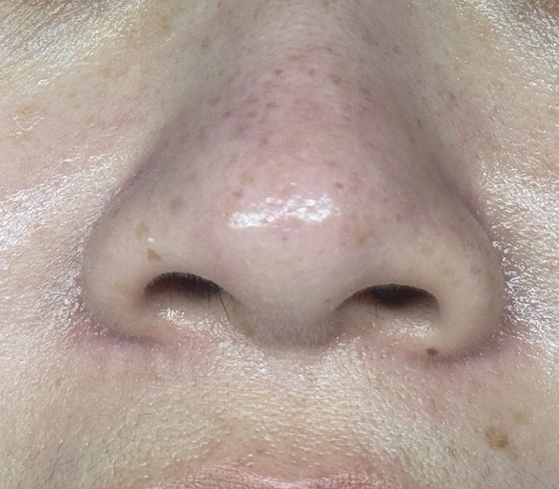 LINE_ALBUM_客照_250407_17 伊登蕾雅美學顧客案例