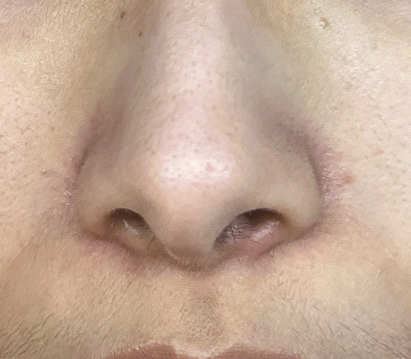 LINE_ALBUM_客照_250407_18 伊登蕾雅美學顧客案例