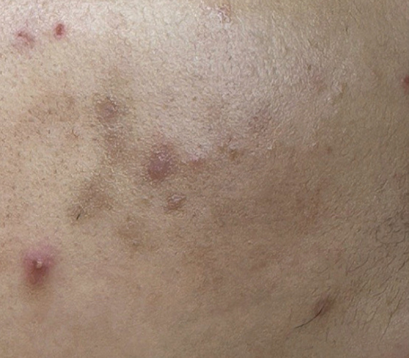 LINE_ALBUM_客照_250407_19 伊登蕾雅美學顧客案例