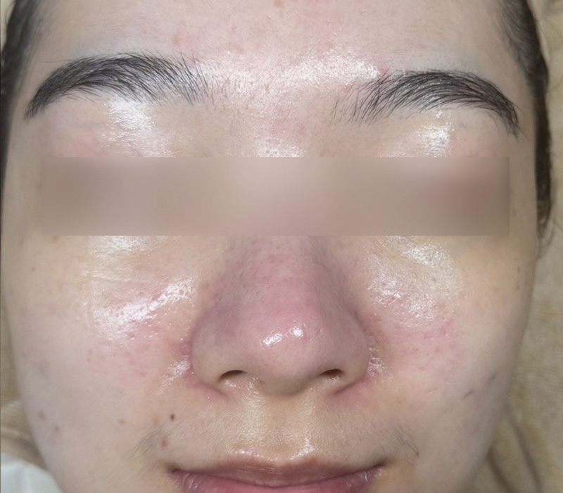 LINE_ALBUM_客照_250407_2 伊登蕾雅美學顧客案例