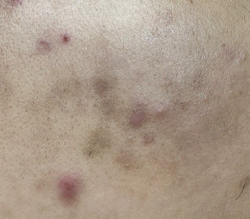 LINE_ALBUM_客照_250407_20 伊登蕾雅美學顧客案例