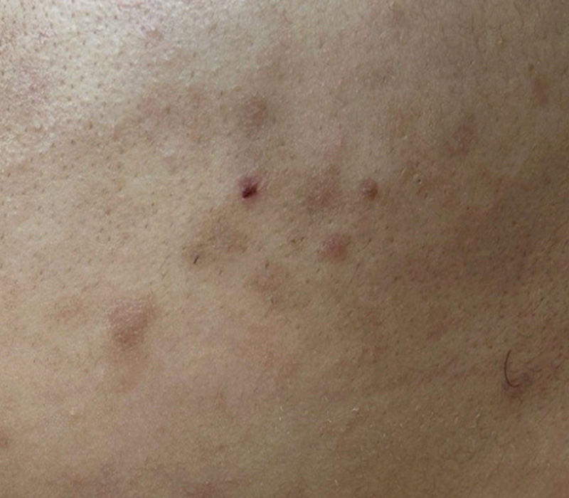 LINE_ALBUM_客照_250407_21 伊登蕾雅美學顧客案例