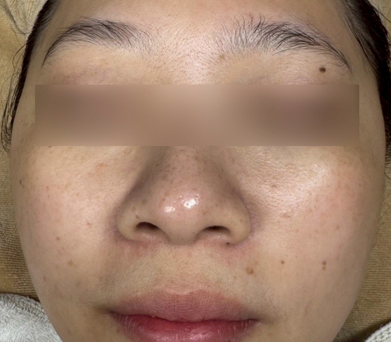 LINE_ALBUM_客照_250407_3 伊登蕾雅美學顧客案例