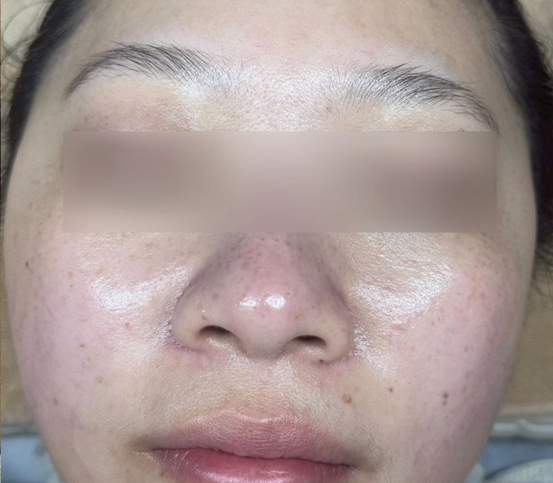 LINE_ALBUM_客照_250407_4 伊登蕾雅美學顧客案例