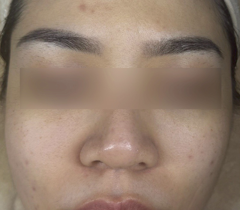 LINE_ALBUM_客照_250407_5 伊登蕾雅美學顧客案例