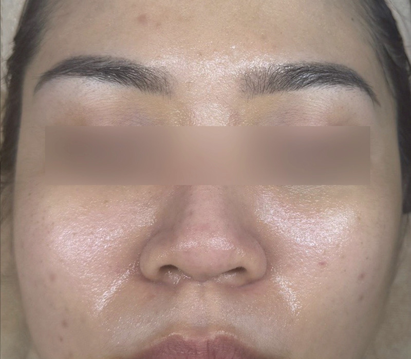 LINE_ALBUM_客照_250407_6 伊登蕾雅美學顧客案例