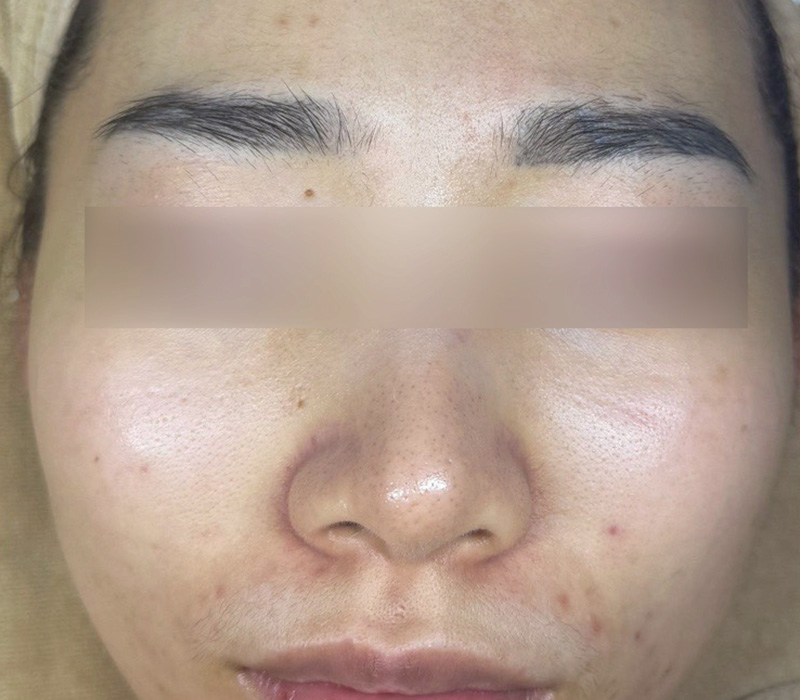 LINE_ALBUM_客照_250407_7 伊登蕾雅美學顧客案例