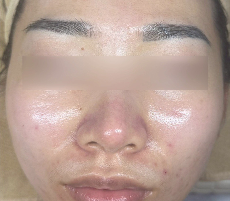 LINE_ALBUM_客照_250407_8 伊登蕾雅美學顧客案例