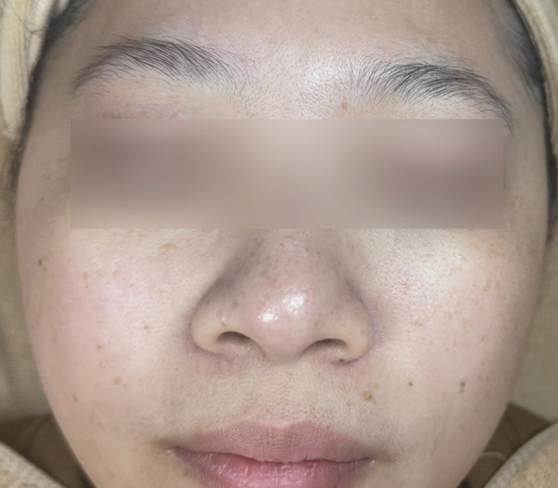 LINE_ALBUM_客照_250407_9 伊登蕾雅美學顧客案例